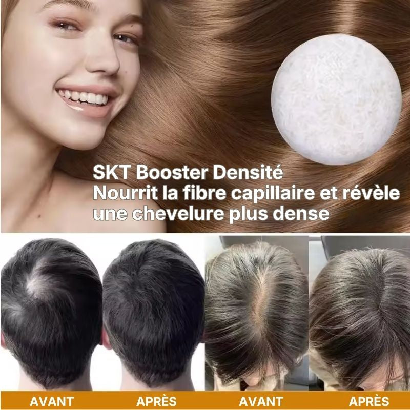 SKT BOOSTER DENSITÉ